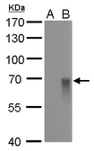 Anti-Influenza A virus H1N1 HA (Hemagglutinin) antibody [GT521] used in Western Blot (WB). GTX629746